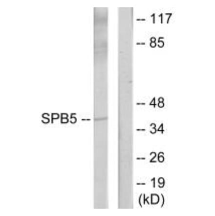 Western blot - Serpin B5 Antibody from Signalway Antibody (34298) - Antibodies.com