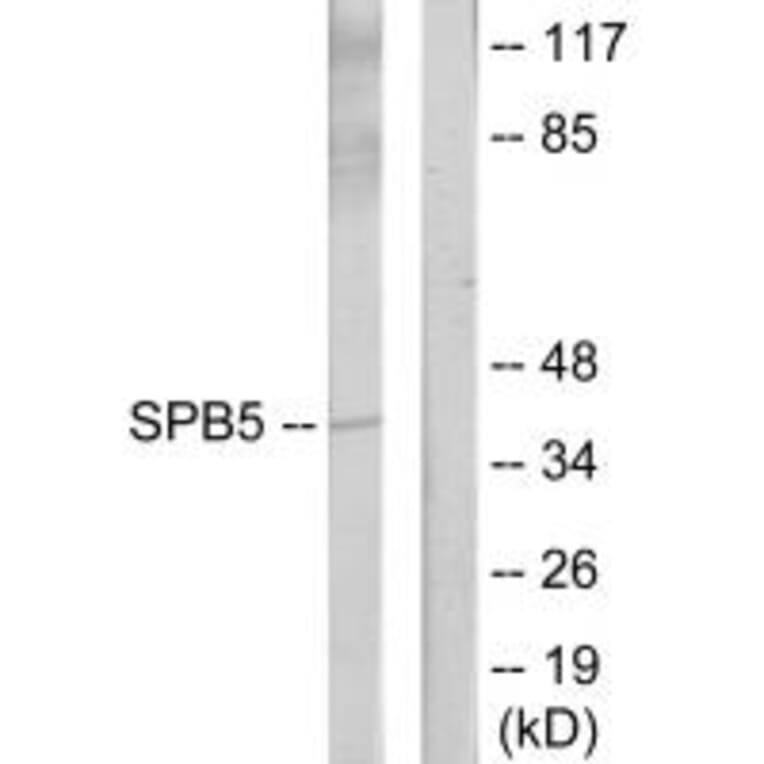 Western blot - Serpin B5 Antibody from Signalway Antibody (34298) - Antibodies.com
