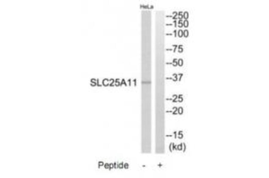 Western blot - SLC25A11 Antibody from Signalway Antibody (34800) - Antibodies.com