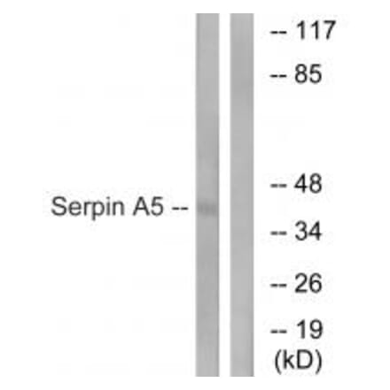 Western blot - Serpin A5 Antibody from Signalway Antibody (34908) - Antibodies.com