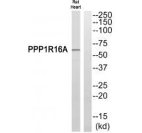 Western blot - PPP1R16A Antibody from Signalway Antibody (34932) - Antibodies.com