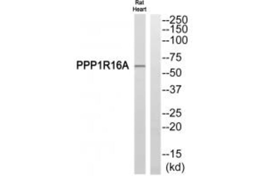 Western blot - PPP1R16A Antibody from Signalway Antibody (34932) - Antibodies.com