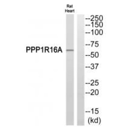 Western blot - PPP1R16A Antibody from Signalway Antibody (34932) - Antibodies.com