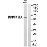 Western blot - PPP1R16A Antibody from Signalway Antibody (34932) - Antibodies.com