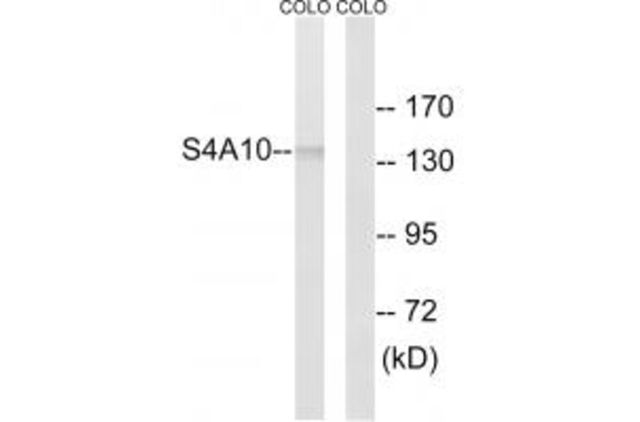 Western blot - SLC4A8/10 Antibody from Signalway Antibody (35066) - Antibodies.com