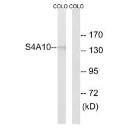Western blot - SLC4A8/10 Antibody from Signalway Antibody (35066) - Antibodies.com