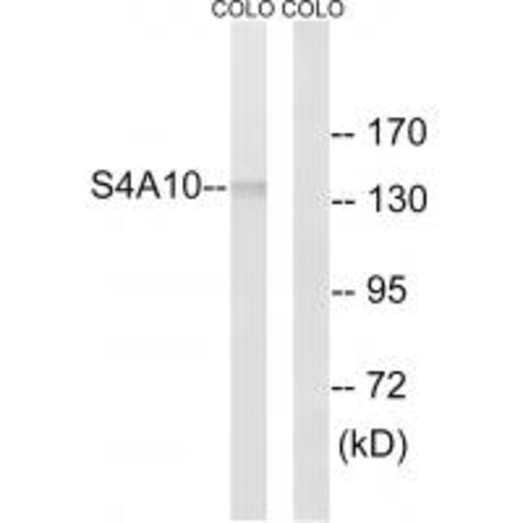Western blot - SLC4A8/10 Antibody from Signalway Antibody (35066) - Antibodies.com