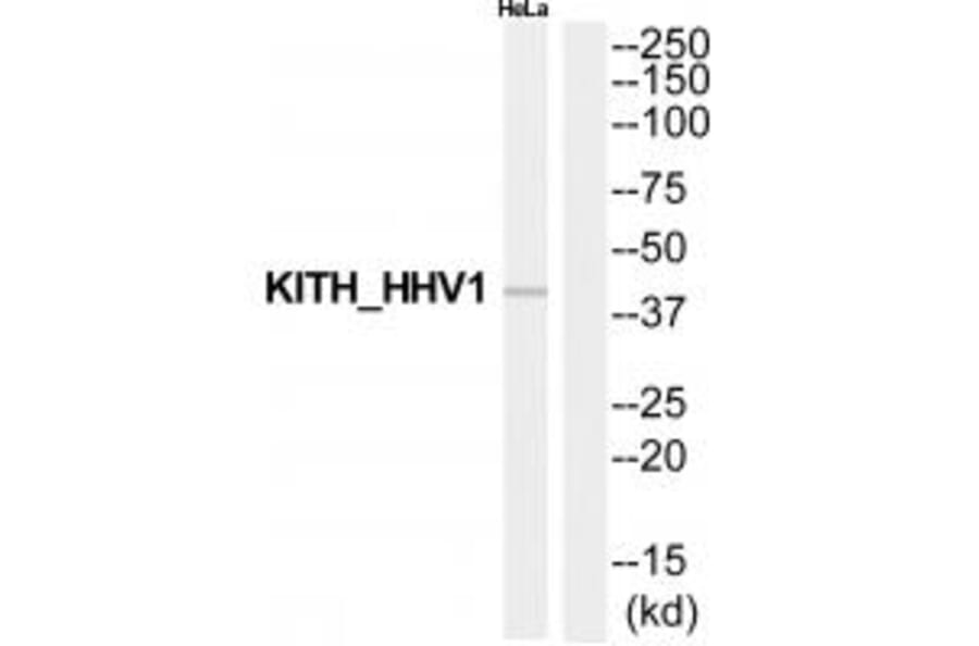 Western blot - KITH_HHV1 Antibody from Signalway Antibody (35204) - Antibodies.com