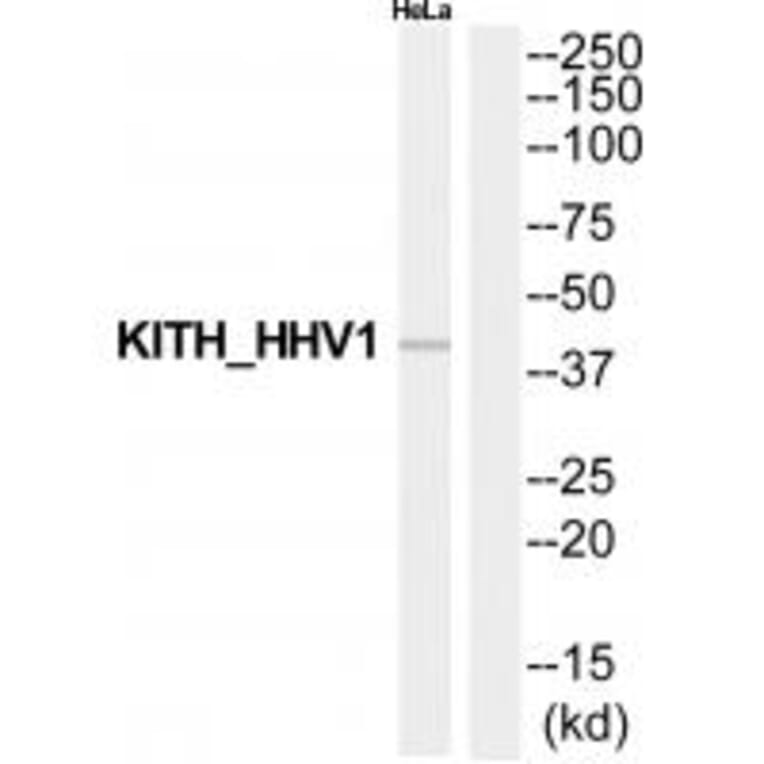 Western blot - KITH_HHV1 Antibody from Signalway Antibody (35204) - Antibodies.com