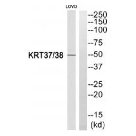 Western blot - KRT37/38 Antibody from Signalway Antibody (35229) - Antibodies.com