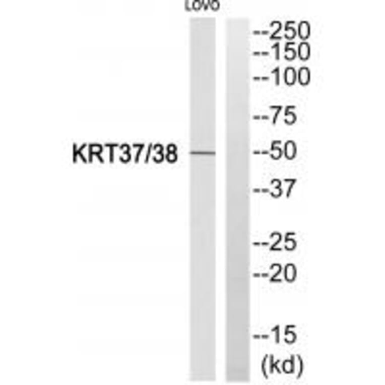 Western blot - KRT37/38 Antibody from Signalway Antibody (35229) - Antibodies.com