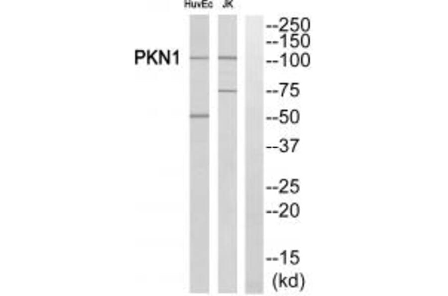 Western blot - PKN1/PRK1 Antibody from Signalway Antibody (35295) - Antibodies.com