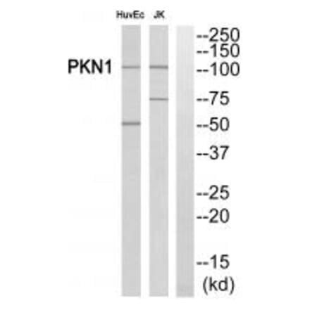 Western blot - PKN1/PRK1 Antibody from Signalway Antibody (35295) - Antibodies.com