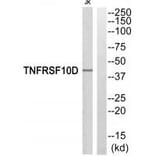 Western blot - TNFRSF10D Antibody from Signalway Antibody (35312) - Antibodies.com