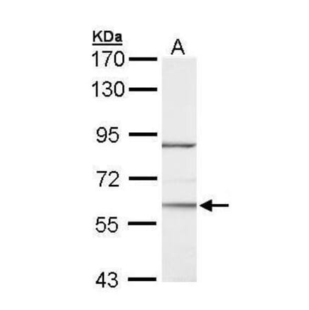 ROR alpha Antibody from Signalway Antibody (35333) - Antibodies.com