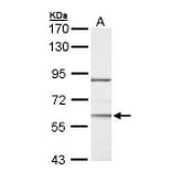 ROR alpha Antibody from Signalway Antibody (35333) - Antibodies.com
