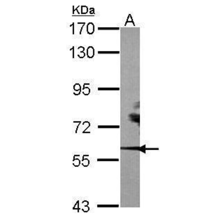 ROR alpha Antibody from Signalway Antibody (35333) - Antibodies.com