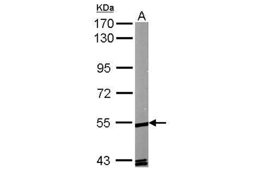 ROR alpha Antibody from Signalway Antibody (35333) - Antibodies.com