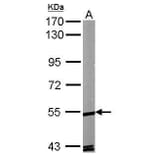 ROR alpha Antibody from Signalway Antibody (35333) - Antibodies.com