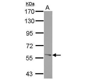 ROR alpha Antibody from Signalway Antibody (35456) - Antibodies.com