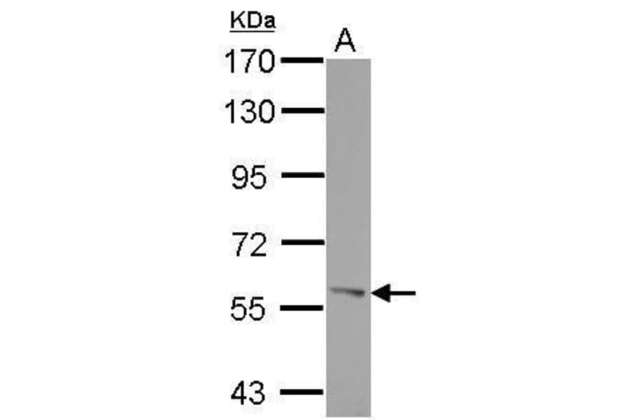 ROR alpha Antibody from Signalway Antibody (35456) - Antibodies.com