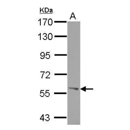 ROR alpha Antibody from Signalway Antibody (35456) - Antibodies.com