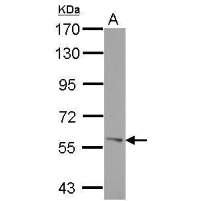 ROR alpha Antibody from Signalway Antibody (35456) - Antibodies.com