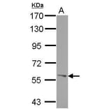 ROR alpha Antibody from Signalway Antibody (35456) - Antibodies.com