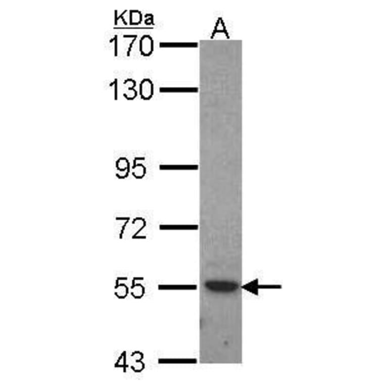 ROR alpha Antibody from Signalway Antibody (35456) - Antibodies.com