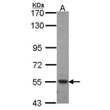 ROR alpha Antibody from Signalway Antibody (35456) - Antibodies.com