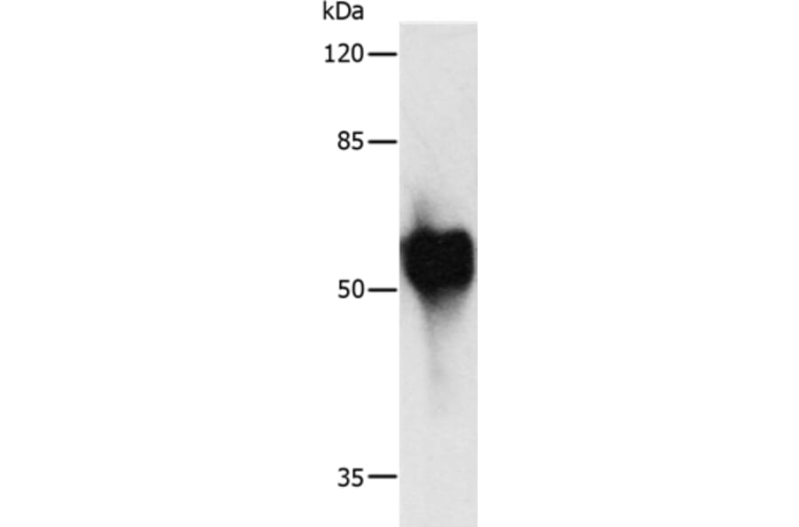 c-Myc Tag Antibody from Signalway Antibody (35536) - Antibodies.com