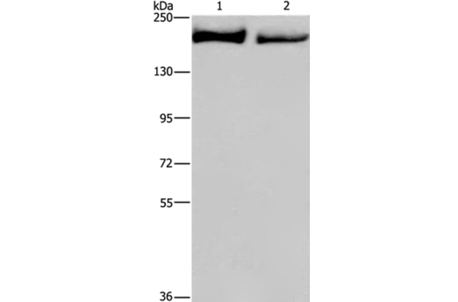KIDINS220 Antibody from Signalway Antibody (37682) - Antibodies.com