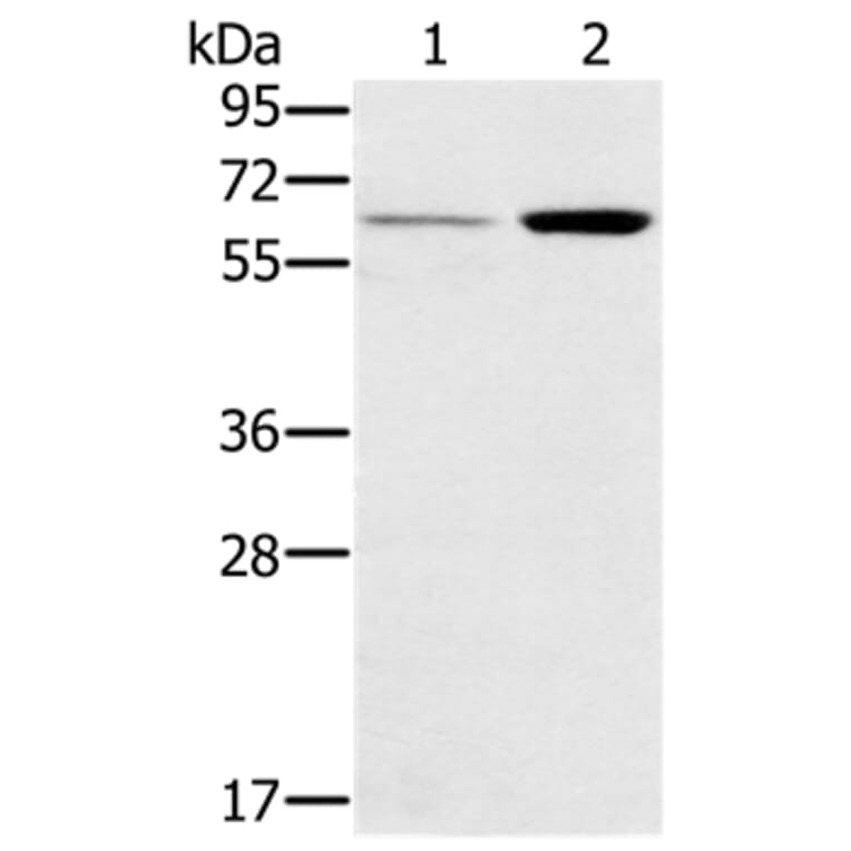 TNFRSF11A Antibody from Signalway Antibody (37860) - Antibodies.com