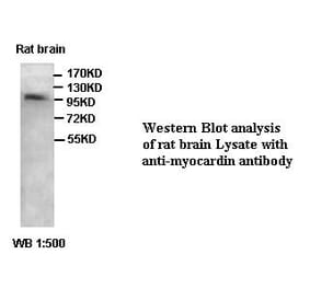 myocardin Antibody from Signalway Antibody (39414) - Antibodies.com