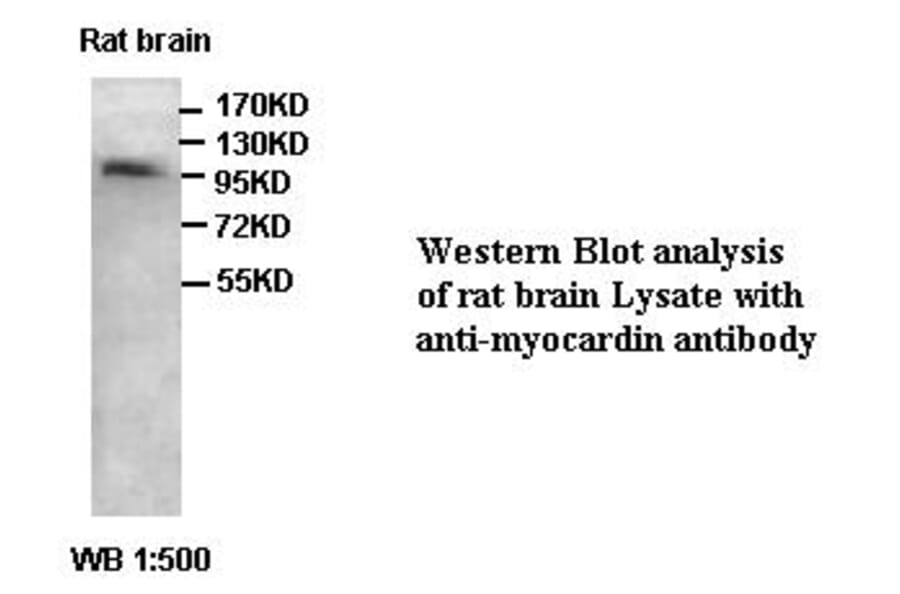 myocardin Antibody from Signalway Antibody (39414) - Antibodies.com