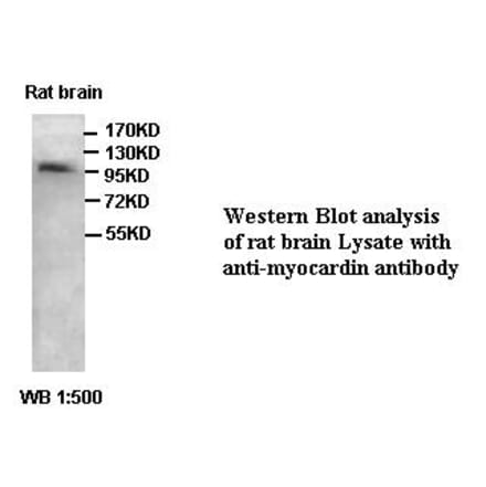 myocardin Antibody from Signalway Antibody (39414) - Antibodies.com