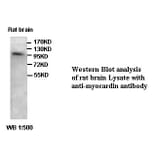 myocardin Antibody from Signalway Antibody (39414) - Antibodies.com