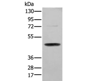 SERPINH1 Antibody from Signalway Antibody (43691) - Antibodies.com