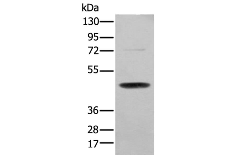SERPINH1 Antibody from Signalway Antibody (43691) - Antibodies.com