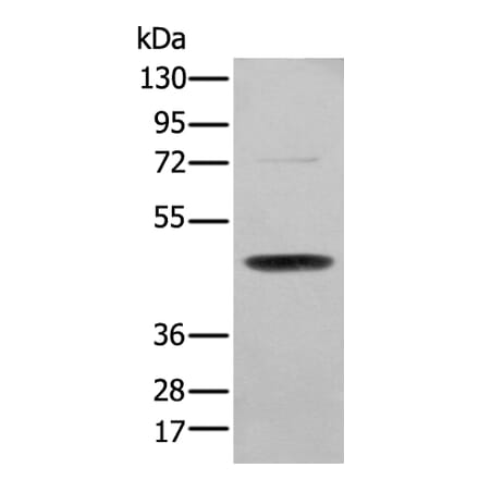 SERPINH1 Antibody from Signalway Antibody (43691) - Antibodies.com