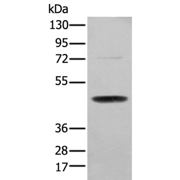 SERPINH1 Antibody from Signalway Antibody (43691) - Antibodies.com