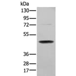 SERPINH1 Antibody from Signalway Antibody (43691) - Antibodies.com