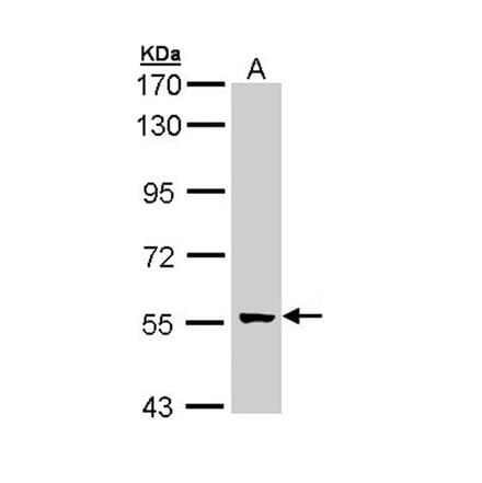 glial cells missing homolog 2 antibody from Signalway Antibody (22128) - Antibodies.com