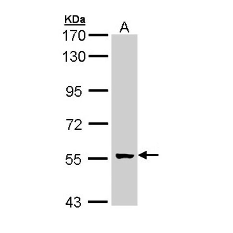 glial cells missing homolog 2 antibody from Signalway Antibody (22128) - Antibodies.com