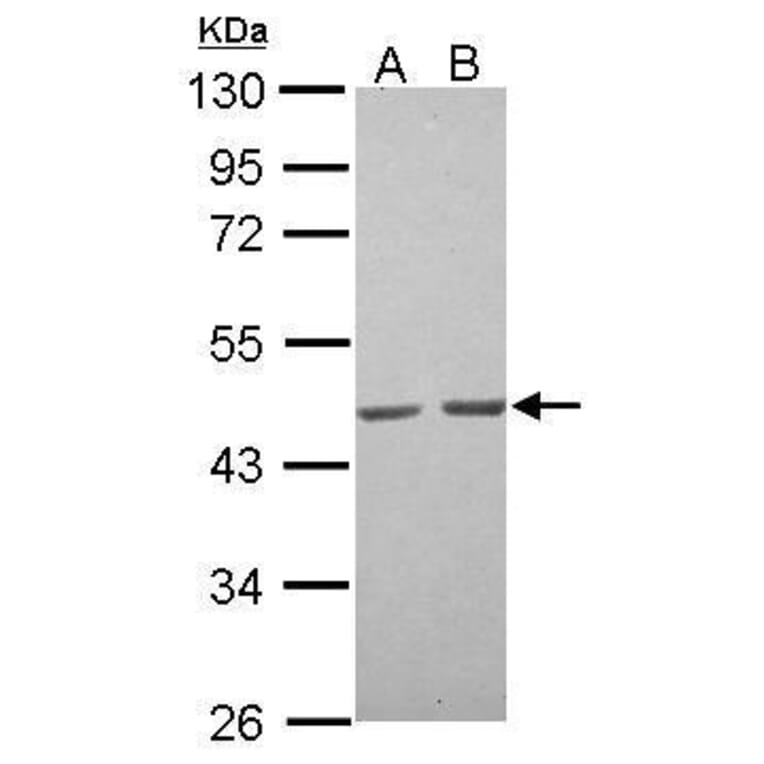 alpha Actin (skeletal muscle) Antibody from Signalway Antibody (35512) - Antibodies.com