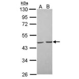 alpha Actin (skeletal muscle) Antibody from Signalway Antibody (35512) - Antibodies.com