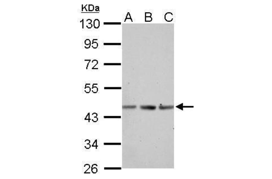 alpha Actin (skeletal muscle) Antibody from Signalway Antibody (35512) - Antibodies.com