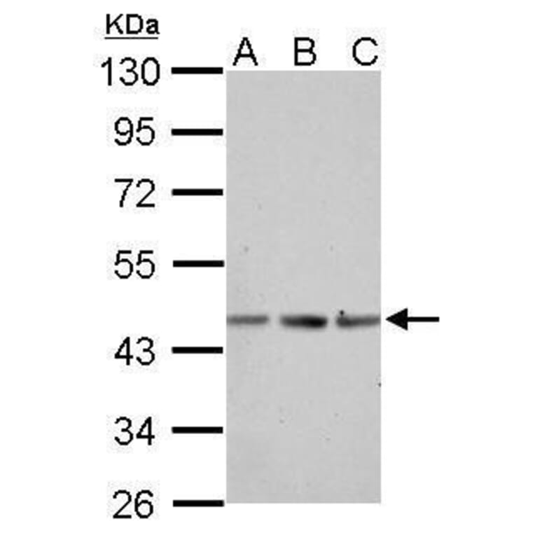 alpha Actin (skeletal muscle) Antibody from Signalway Antibody (35512) - Antibodies.com