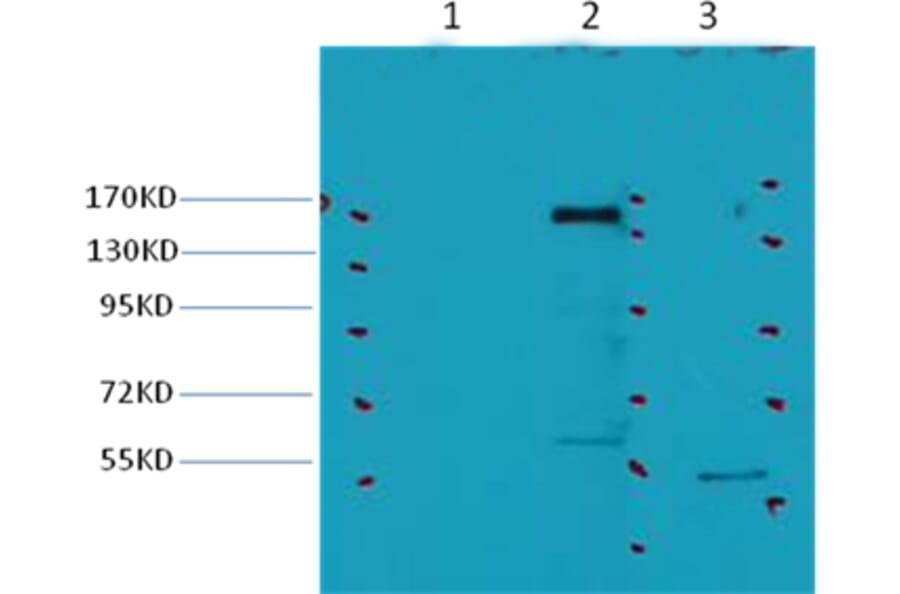 Western blot - ErbB-2/HER-2 Mouse Monoclonal Antibody from Signalway Antibody (38036) - Antibodies.com