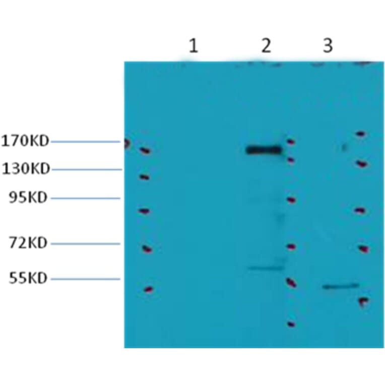 Western blot - ErbB-2/HER-2 Mouse Monoclonal Antibody from Signalway Antibody (38036) - Antibodies.com